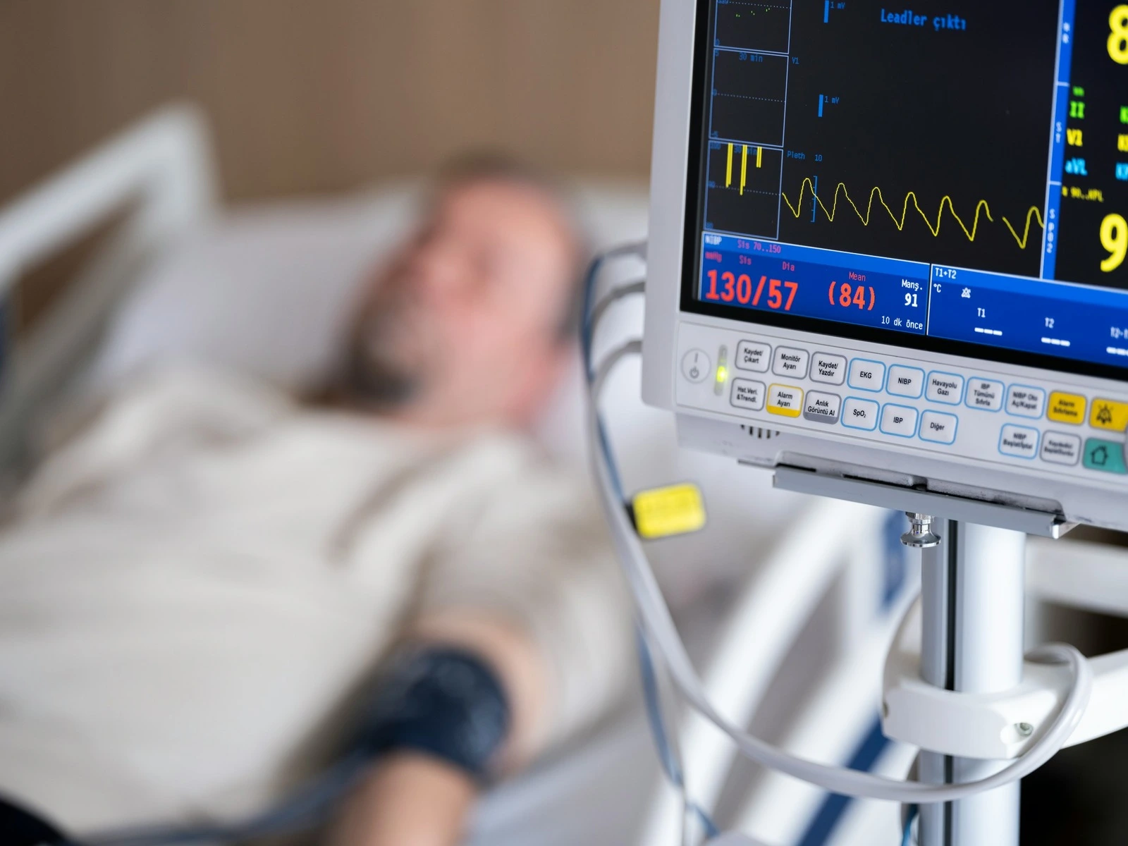 Person with barbiturate poisoning lying in hospital bed with heart monitor in focus.