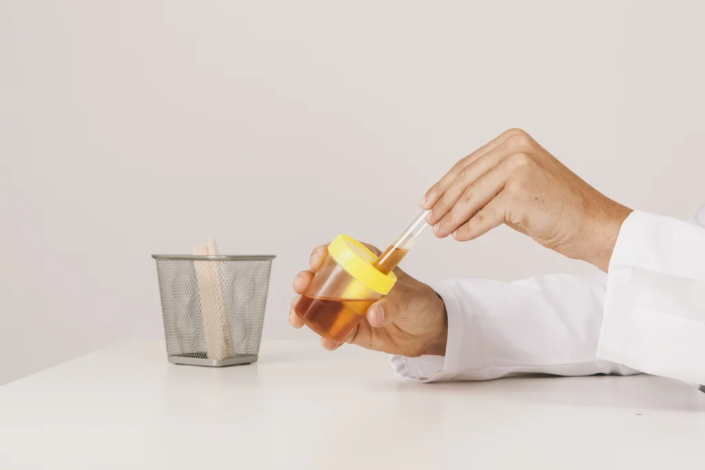 Can a Urine Drug Test Show How Much You Take? A hand testing a urine sample.